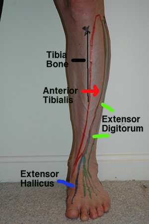 Muscles of shin marked with colored ink on leg