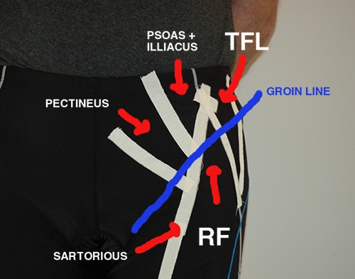 anthipmuscles.jpg