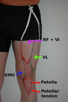 quadmuscles.jpg